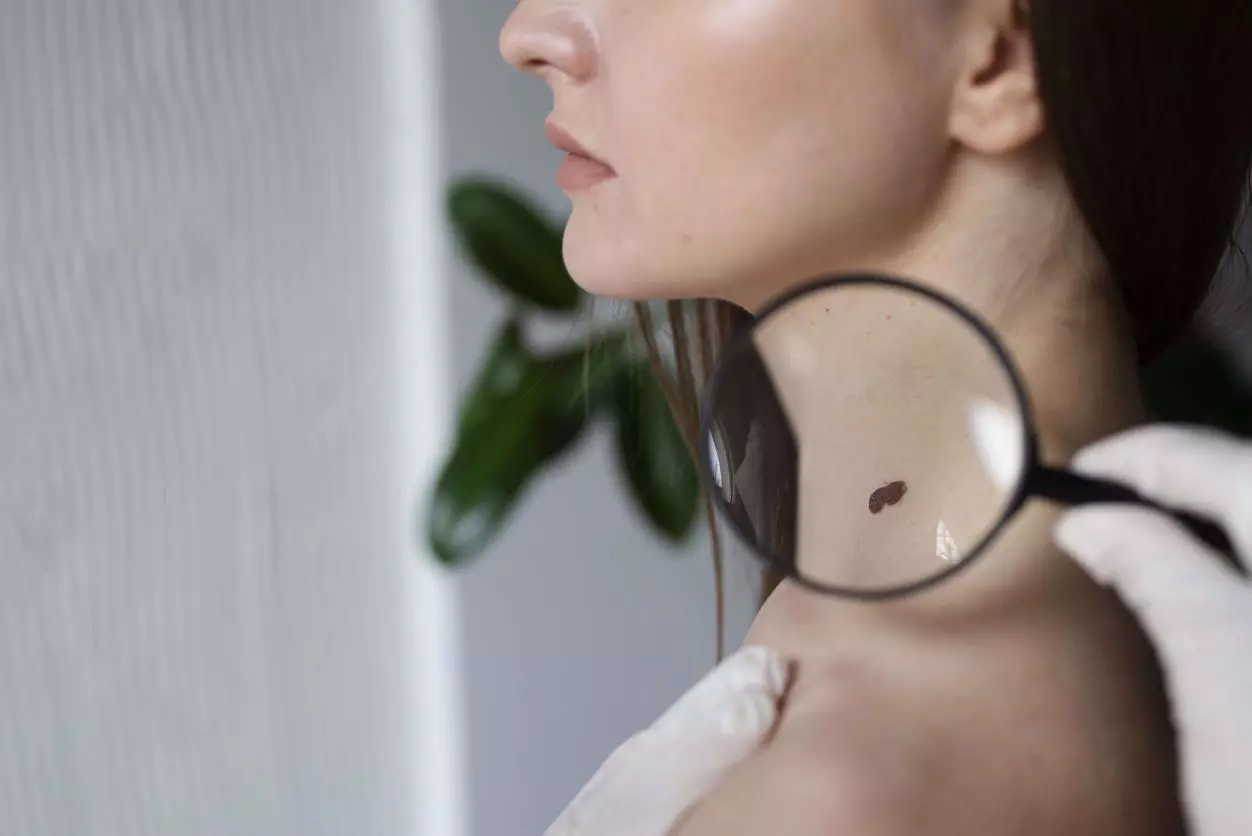 Dermatologia Cirúrgica