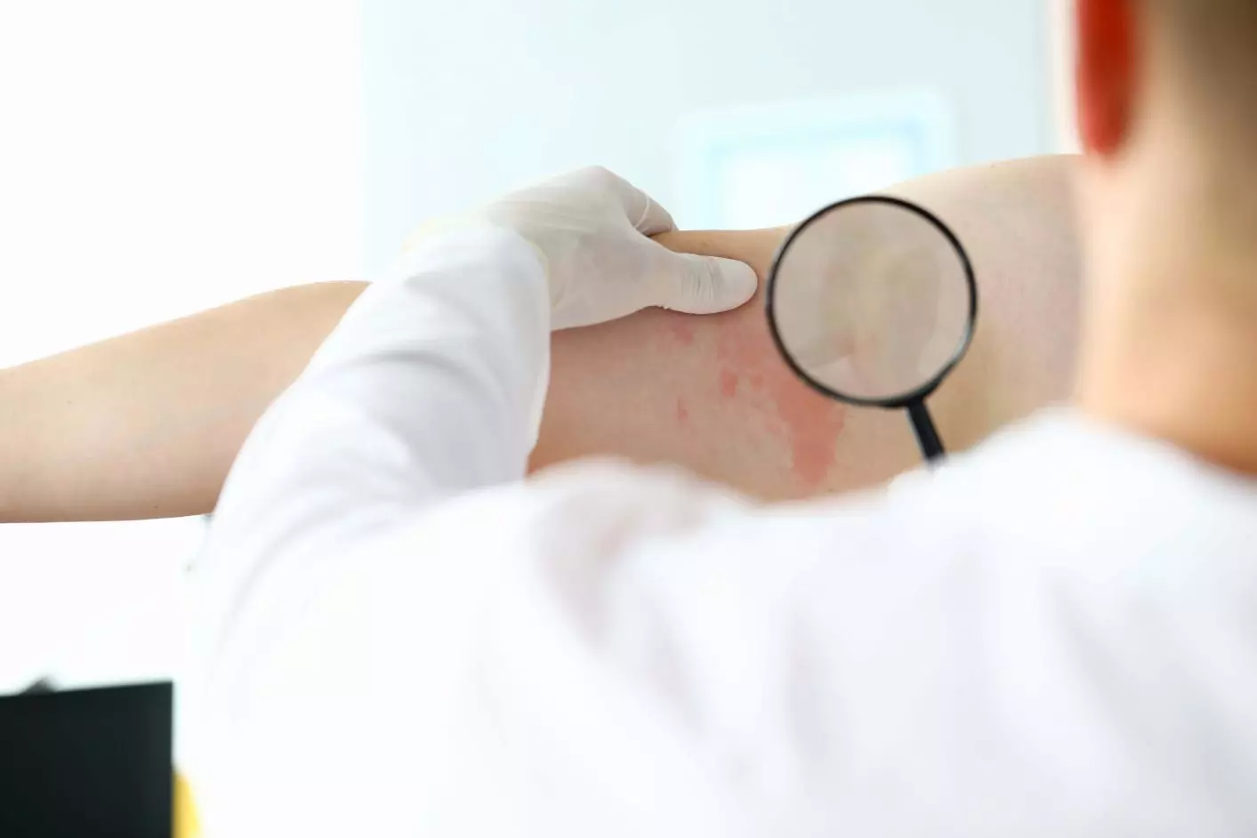 Dermatologia Clínica